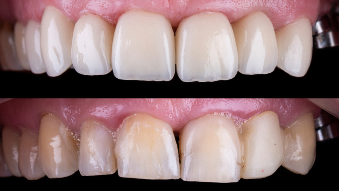 Cosmetic-dentistry1.jpg